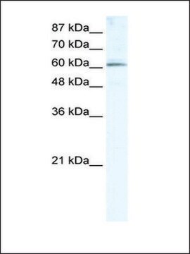 Anti-METTL3 (AB1) antibody produced in rabbit IgG fraction of antiserum