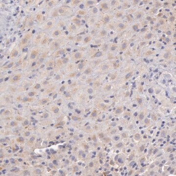 Anti-C1R antibody produced in rabbit Prestige Antibodies&#174; Powered by Atlas Antibodies, affinity isolated antibody