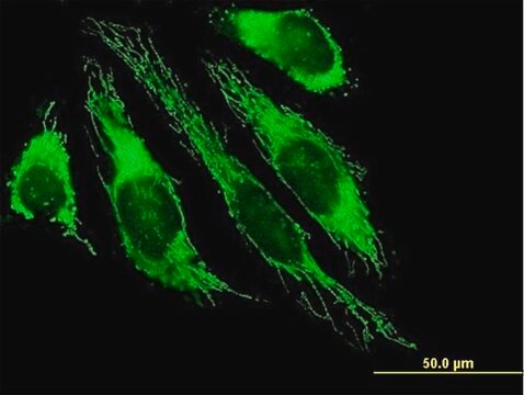 Anti-PDHB antibody produced in mouse purified immunoglobulin, buffered aqueous solution