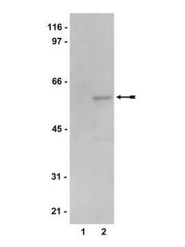 Anticuerpo anti-AMPK &#945;2 Upstate&#174;, from rabbit