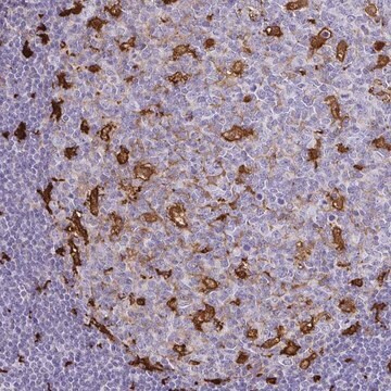 Anti-GSN Prestige Antibodies&#174; Powered by Atlas Antibodies, affinity isolated antibody