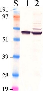 Anti-Retinales-Pigmentepithel-65-Antikörper clone 401.8B11.3D9, Chemicon&#174;, from mouse