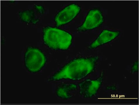 Monoclonal Anti-SSR4 antibody produced in mouse clone 2D3, purified immunoglobulin, buffered aqueous solution