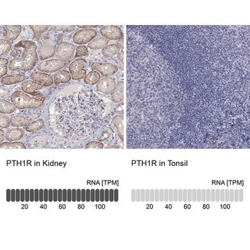 Anti-PTH1R antibody produced in rabbit Prestige Antibodies&#174; Powered by Atlas Antibodies, affinity isolated antibody, buffered aqueous glycerol solution