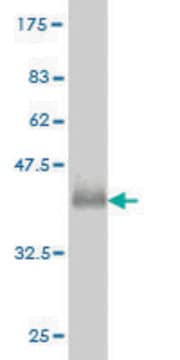 ANTI-GUCY2D antibody produced in mouse clone 5E10, purified immunoglobulin, buffered aqueous solution