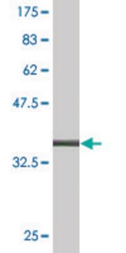 モノクローナル抗LCN1抗体 マウス宿主抗体 clone 1B11, purified immunoglobulin, buffered aqueous solution