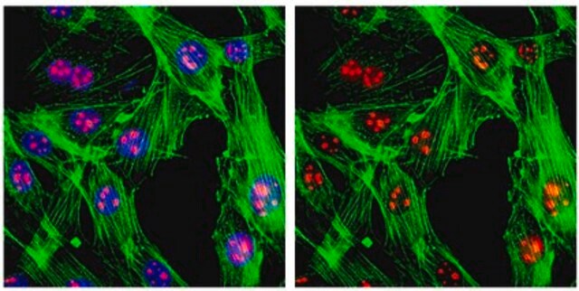 抗SC-35抗体、クローン1SC-4F11 ascites fluid, clone 1SC-4F11, from mouse