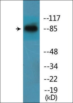 Anti-phospho-Catenin-&#946; (pTyr654) antibody produced in rabbit affinity isolated antibody