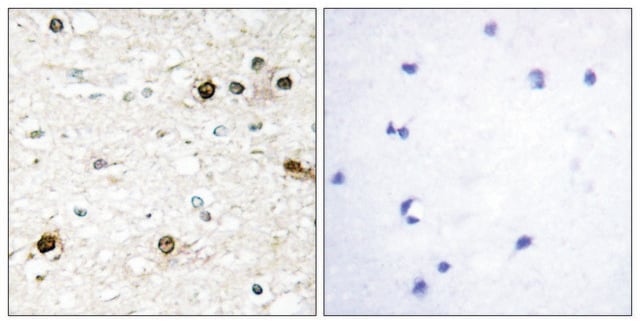 Anti-NAB2 antibody produced in rabbit affinity isolated antibody