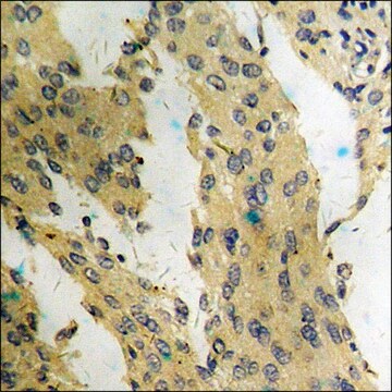 抗 磷酸化-mTOR (pSer 2448 ) 兔抗 affinity isolated antibody