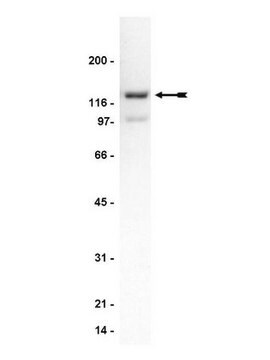 Anticorps anti-spinophiline/neurabine-II Upstate&#174;, from rabbit