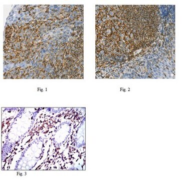 Anti-MSN Antibody, clone 2C12 ascites fluid, clone 2C12, from mouse