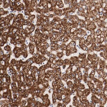 Anti-GIT1 antibody produced in rabbit Ab2, Prestige Antibodies&#174; Powered by Atlas Antibodies, affinity isolated antibody, buffered aqueous glycerol solution