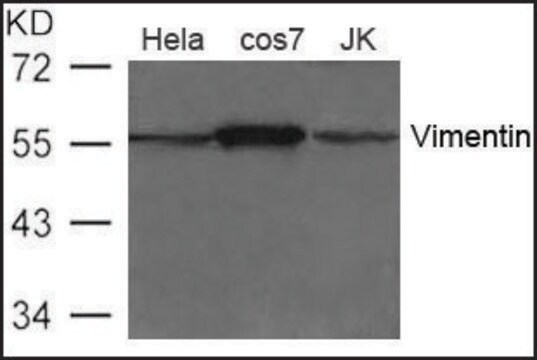 Anti-Vimentin antibody produced in rabbit affinity isolated antibody