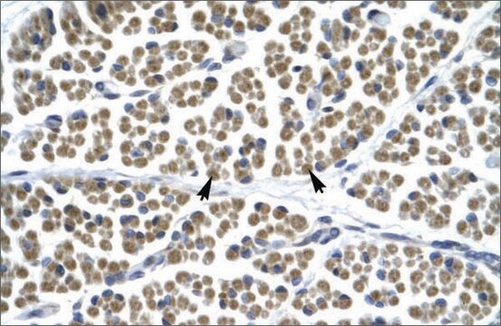 Anti-GABRD antibody produced in rabbit affinity isolated antibody