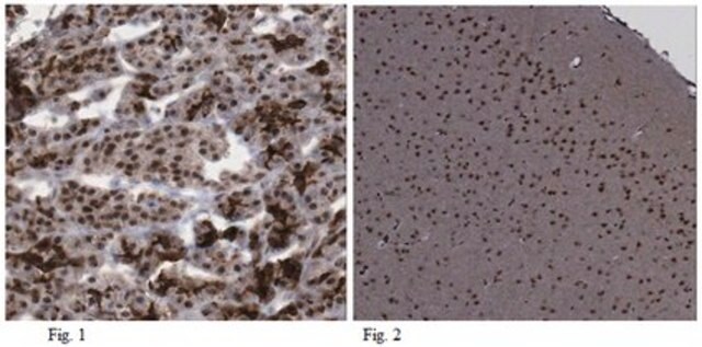 Anti-MNX1 (HB9) Antibody from rabbit, purified by affinity chromatography