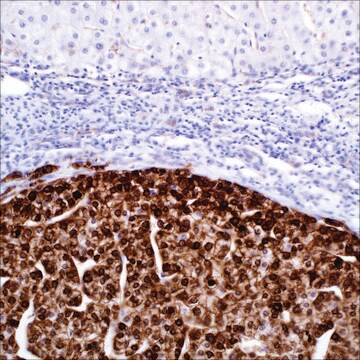 Glutamine Synthetase (GS-6) Mouse Monoclonal Antibody