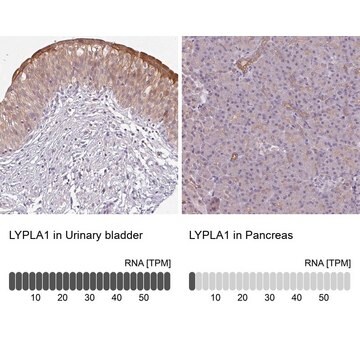 抗LYPLA1抗体 ウサギ宿主抗体 Prestige Antibodies&#174; Powered by Atlas Antibodies, affinity isolated antibody, buffered aqueous glycerol solution