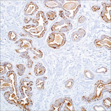 Cytokeratin, LMW (AE1) Mouse Monoclonal Antibody