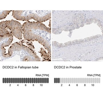 抗DCDC2抗体 ウサギ宿主抗体 Prestige Antibodies&#174; Powered by Atlas Antibodies, affinity isolated antibody, buffered aqueous glycerol solution