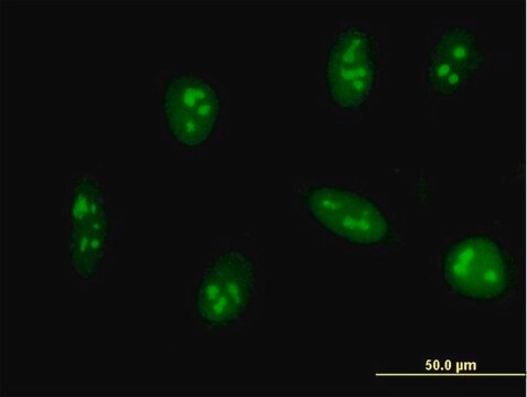 Monoclonal Anti-EXOSC5 antibody produced in mouse clone 6G11, purified immunoglobulin, buffered aqueous solution