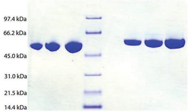 アンチトロンビン III ヒト血漿由来 &#8805;95% (SDS-PAGE)