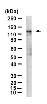 Anti-CDKL5/STK9 Antibody, clone 8F3.1 ZooMAb&#174; Mouse Monoclonal recombinant, expressed in HEK 293 cells