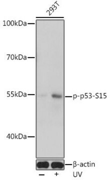 Anti-Phospho-TP53-S15 antibody produced in rabbit