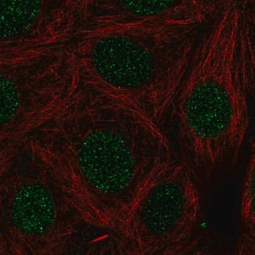 Anty-LMX1B Prestige Antibodies&#174; Powered by Atlas Antibodies, affinity isolated antibody