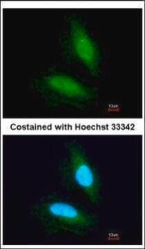 Anti-NPEPPS antibody produced in rabbit affinity isolated antibody, buffered aqueous solution