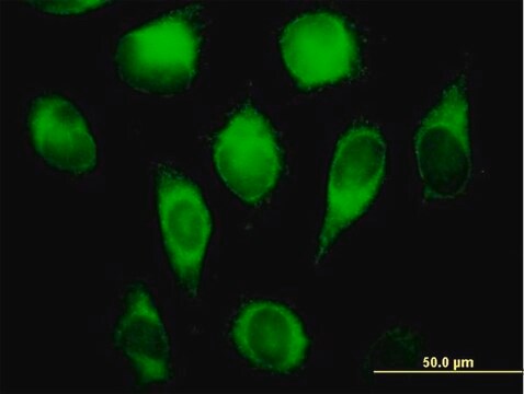 Anti-CYB5R3 antibody produced in mouse purified immunoglobulin, buffered aqueous solution