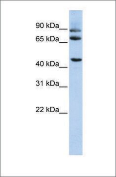 Anti-DPP10 antibody produced in rabbit affinity isolated antibody