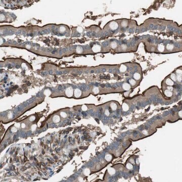 Anti-GPR161 antibody produced in rabbit Prestige Antibodies&#174; Powered by Atlas Antibodies, affinity isolated antibody, buffered aqueous glycerol solution