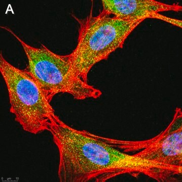 Anti-phospho-IRE-1&#945; (Ser724) Antibody, clone 1M2 ZooMAb&#174; Rabbit Monoclonal recombinant, expressed in HEK 293 cells