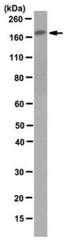 Anticuerpo anti-P-Rex1, clon 6F12 clone 6F12, from mouse