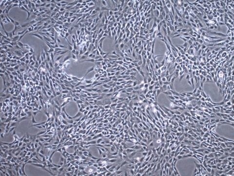 Lignée des chondrocytes humains C20A4 C20A4 Human Chondrocyte Cell Line is widely used as a model cell line for studying normal and pathological cartilage repair mechanisms related to chondrocyte biology and physiology.