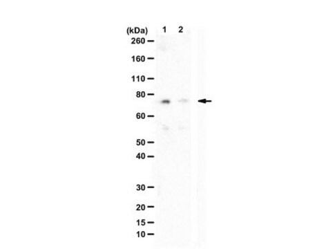 Anti-phospho AEP (Ser226) from rabbit