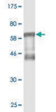 Monoclonal Anti-RCN1 antibody produced in mouse clone 4D9-G3, purified immunoglobulin, buffered aqueous solution