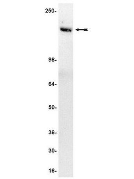 Anticorpo anti-Tie2/TEK, clone Ab33 clone Ab33, Upstate&#174;, from mouse