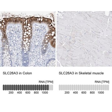 抗SLC26A3 ウサギ宿主抗体 Prestige Antibodies&#174; Powered by Atlas Antibodies, affinity isolated antibody, buffered aqueous glycerol solution