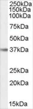 Anti-IL12B/IL12P40 (AB1) antibody produced in goat affinity isolated antibody, buffered aqueous solution