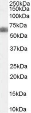 Anti-DKK3/REIC antibody produced in goat affinity isolated antibody, buffered aqueous solution