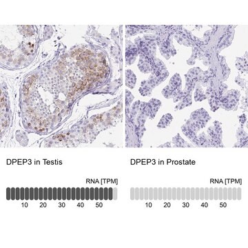 Anti-DPEP3 antibody produced in rabbit Prestige Antibodies&#174; Powered by Atlas Antibodies, affinity isolated antibody, buffered aqueous glycerol solution