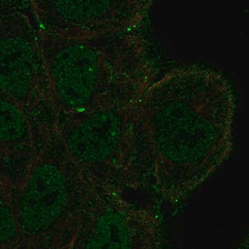 Anti-Notch3 Antibody Produced In Rabbit Prestige Antibodies&#174; Powered by Atlas Antibodies, affinity isolated antibody, buffered aqueous glycerol solution