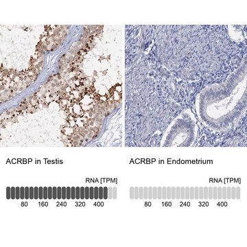 Anti-ACRBP antibody produced in rabbit Prestige Antibodies&#174; Powered by Atlas Antibodies, affinity isolated antibody, buffered aqueous glycerol solution