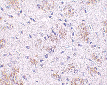 抗KLHL1抗体 ウサギ宿主抗体 affinity isolated antibody, buffered aqueous solution