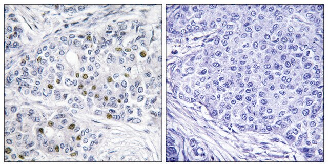 Anti-Retinoblastoma, C-Terminal antibody produced in rabbit affinity isolated antibody