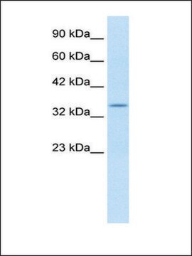 Anti-KCNAB2 (AB2) antibody produced in rabbit IgG fraction of antiserum