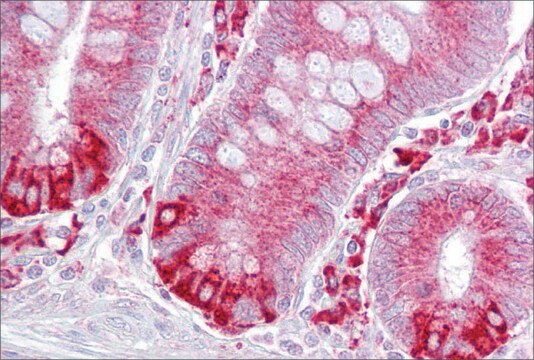 Anti-PDIA6 (ab1) antibody produced in rabbit affinity isolated antibody