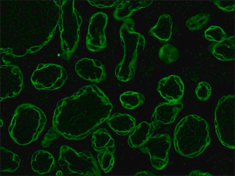 モノクロナール抗サイトケラチン, パン マウス宿主抗体 clone C-11, ascites fluid